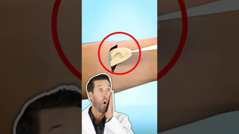 ER Doctor REACTS to Growing an Ear in Your Arm (Zack D. Films)